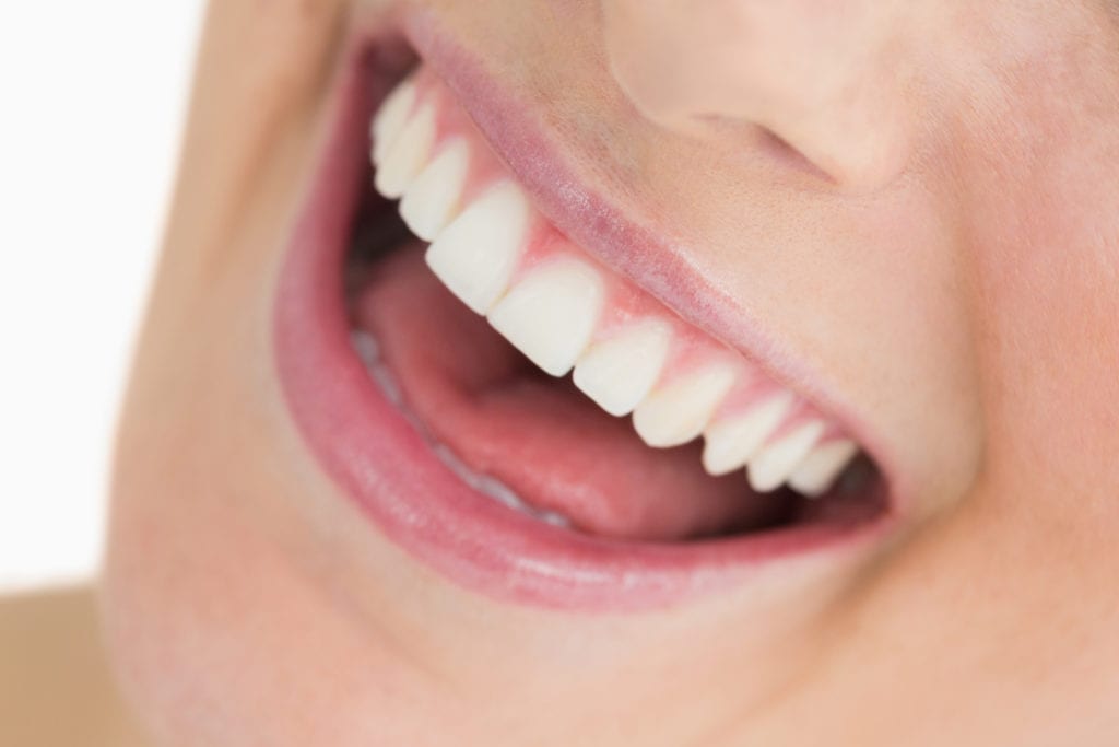 dental filling Indianapolis in