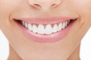 Indianapolis Cosmetic Dentistry with Dr. Marckese-Braun