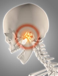 TMJ Therapy in Indianapolis Indiana