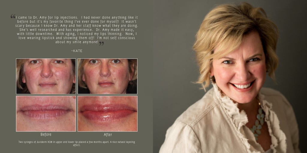 smile makeovers with dr. marckese patient after images