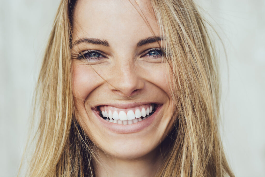 suresmile clear aligners indianapolis in